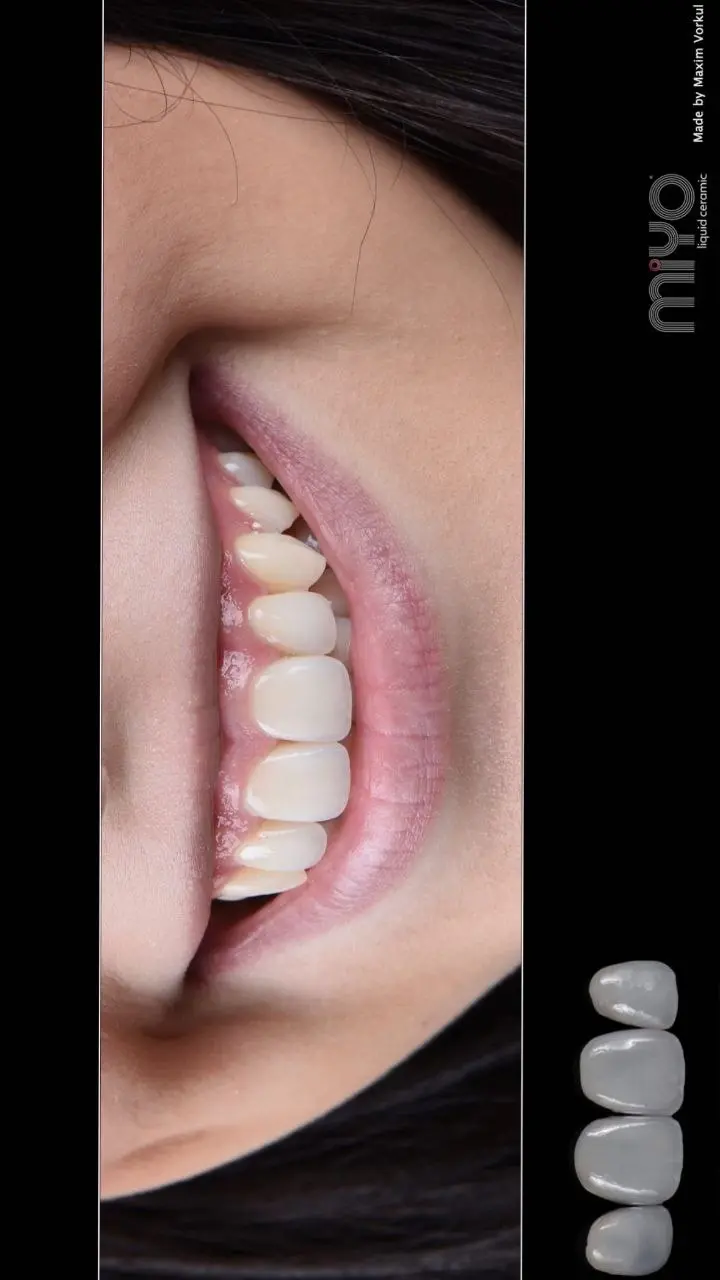 Живая демонстрация