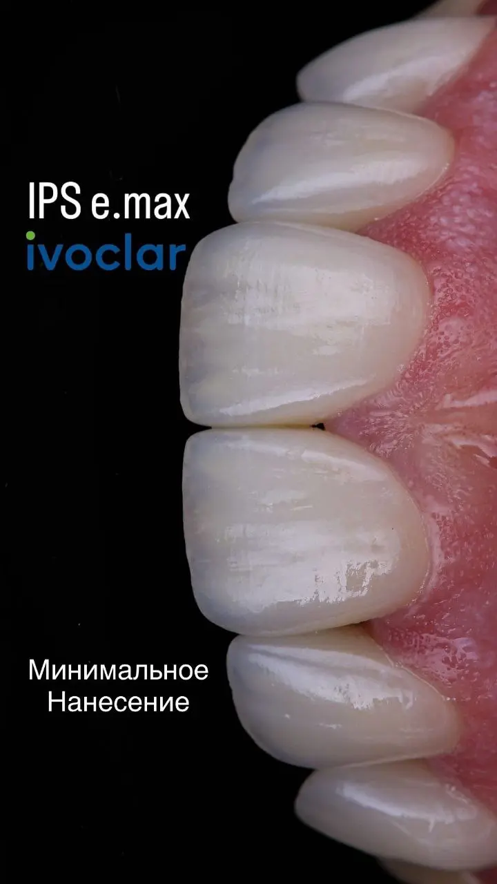 Живая демонстрация