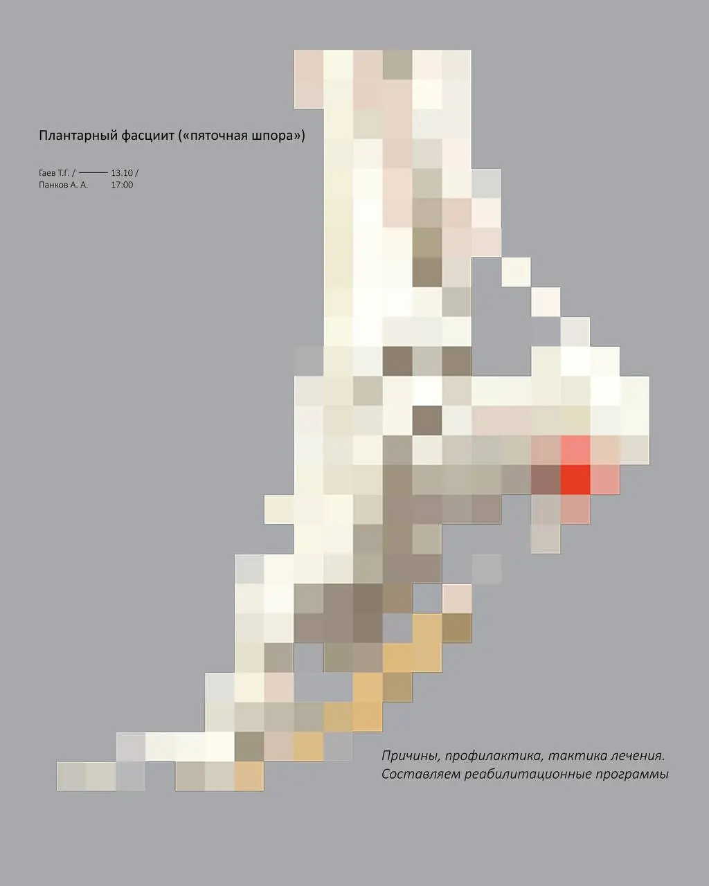 Плантарный фасциит: причины, диагностика и современные подходы к лечению на вебинаре