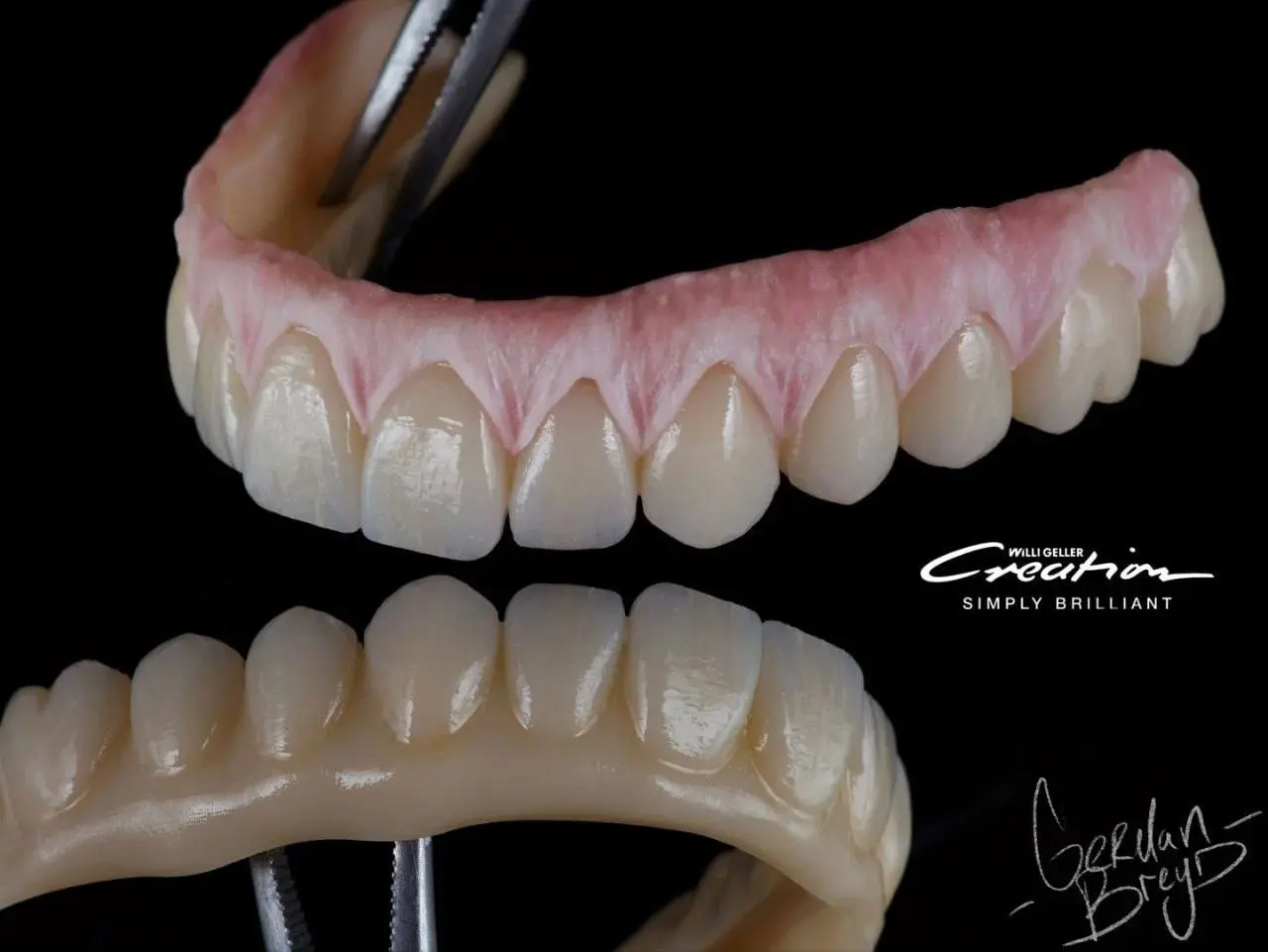 Цельноциркониевые коронки с уровня имплантата. Винтовая фиксация