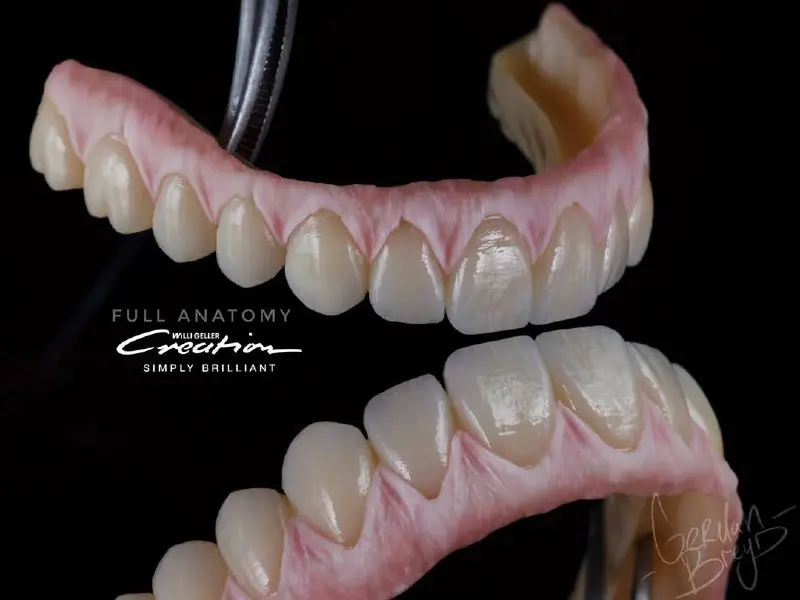 Цельноциркониевые коронки с уровня имплантата. Винтовая фиксация